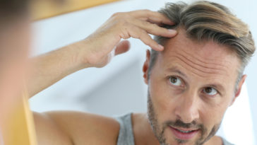hair loss solutions