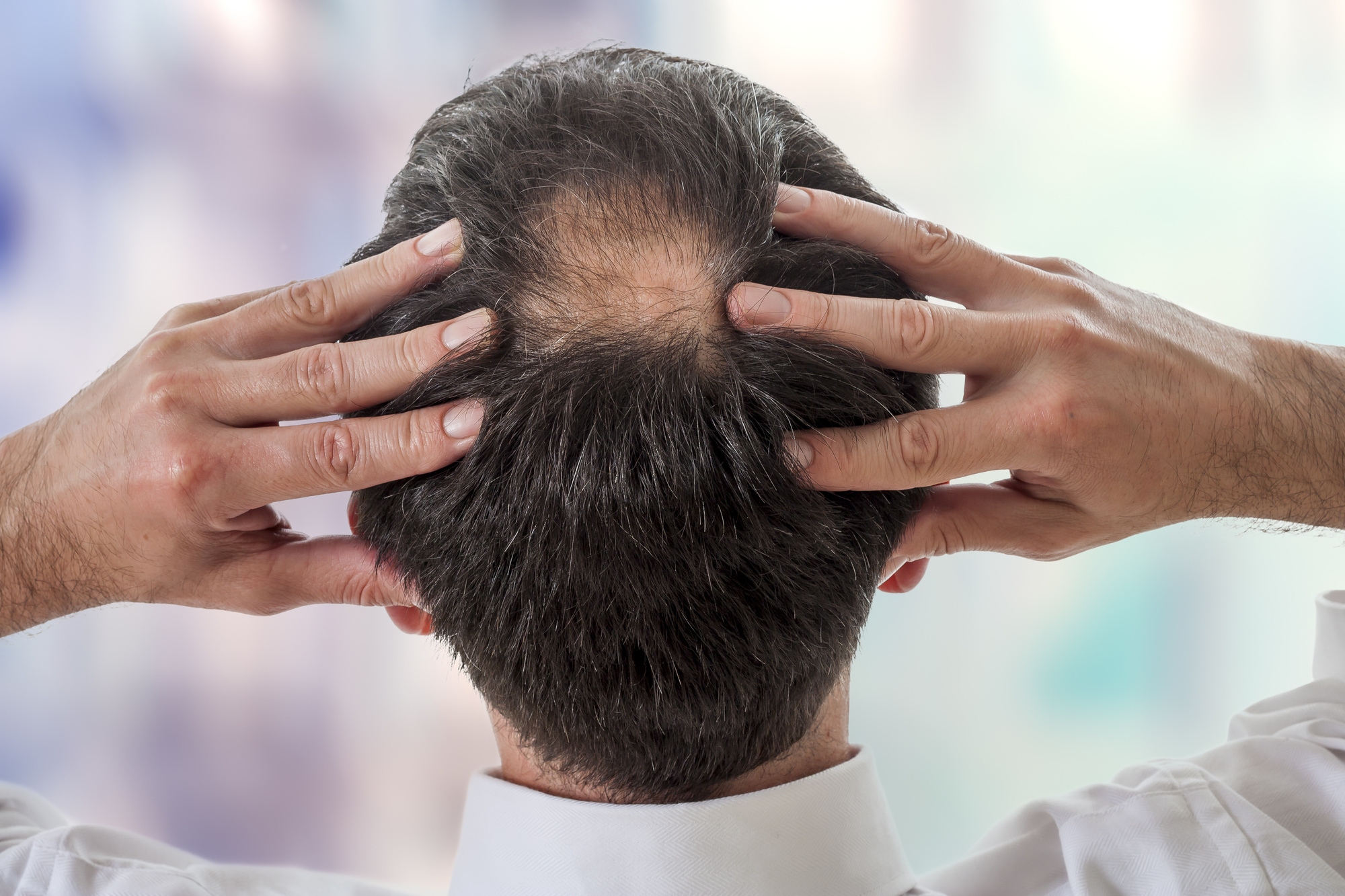 Выпадение волос у мужчин лечение. Облысение у мужчин причины.
